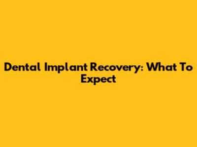 Dental Implant Recovery: What To Expect