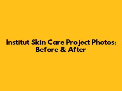 Institut Skin Care Project Photos: Before & After