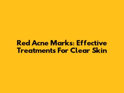 Red Acne Marks: Effective Treatments For Clear Skin